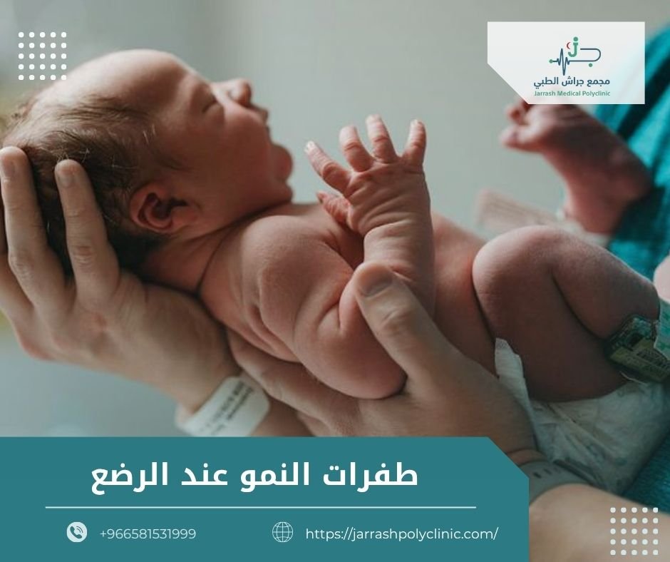 طفرات النمو عند الرضع