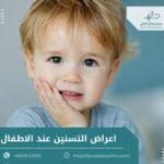 اعراض التسنين عند الاطفال