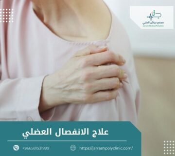 علاج الانفصال العضلي