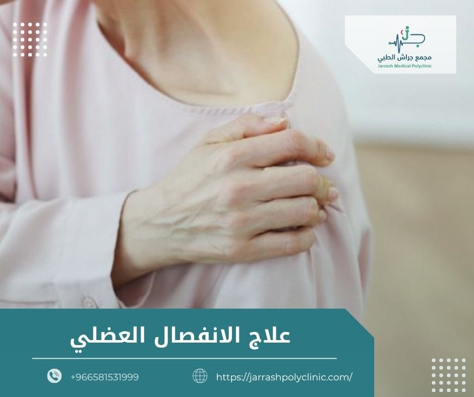 علاج الانفصال العضلي