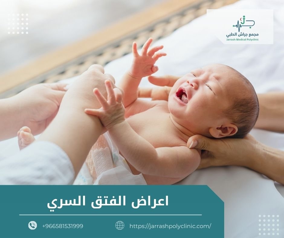 اعراض الفتق السري