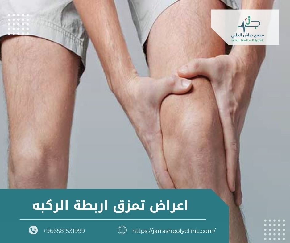 اعراض تمزق اربطة الركبه