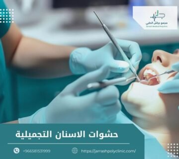 حشوات الاسنان التجميلية